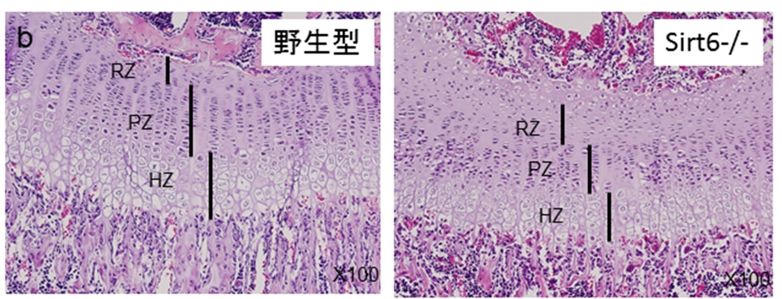 脛骨成長板軟骨　Sirt6-/-では増殖層と肥大軟骨層が短縮し静止層が拡大する。