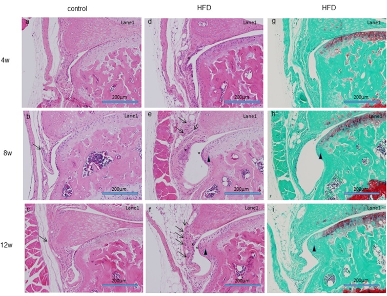 高脂肪食開始後12週（最下段　中央、右）では骨棘形成（▲）と滑膜増生（矢印）が認められる。