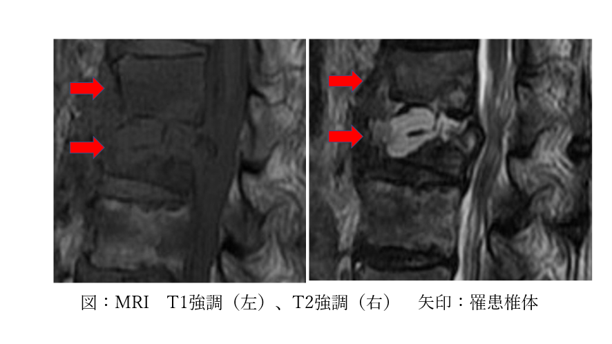 臨床試験で最も有望な治療法は何ですか?