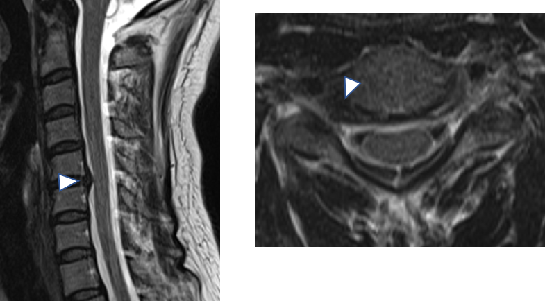 どのように診断されるのでしょうか？